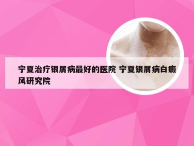宁夏治疗银屑病最好的医院 宁夏银屑病白癜风研究院
