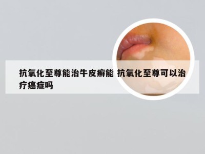 抗氧化至尊能治牛皮癣能 抗氧化至尊可以治疗癌症吗