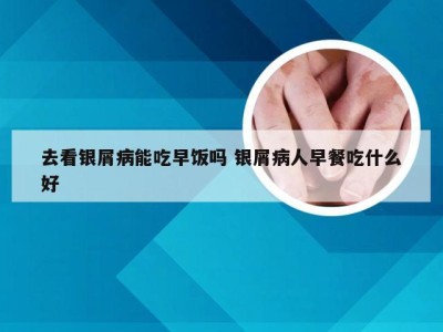 去看银屑病能吃早饭吗 银屑病人早餐吃什么好
