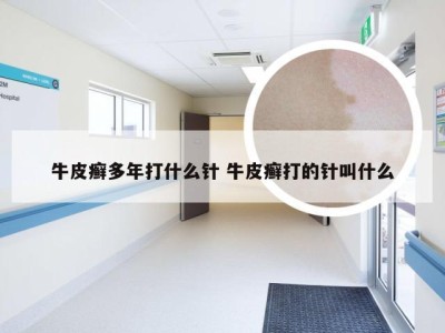 牛皮癣多年打什么针 牛皮癣打的针叫什么