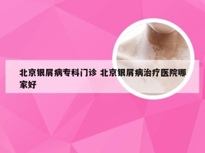 北京银屑病专科门诊 北京银屑病治疗医院哪家好