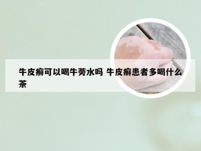 牛皮癣可以喝牛蒡水吗 牛皮癣患者多喝什么茶