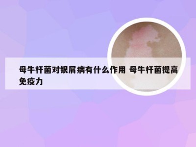 母牛杆菌对银屑病有什么作用 母牛杆菌提高免疫力