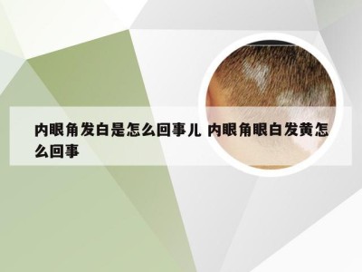 内眼角发白是怎么回事儿 内眼角眼白发黄怎么回事