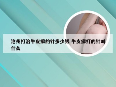 沧州打治牛皮癣的针多少钱 牛皮癣打的针叫什么