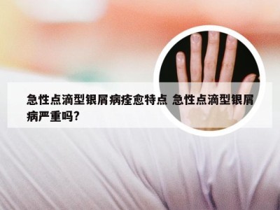 急性点滴型银屑病痊愈特点 急性点滴型银屑病严重吗?