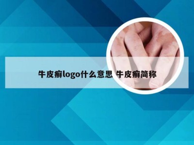 牛皮癣logo什么意思 牛皮癣简称