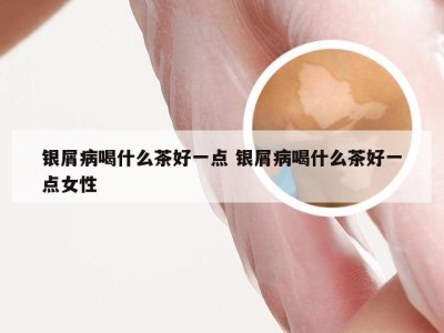 银屑病喝什么茶好一点 银屑病喝什么茶好一点女性