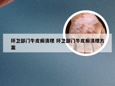 环卫部门牛皮癣清理 环卫部门牛皮癣清理方案