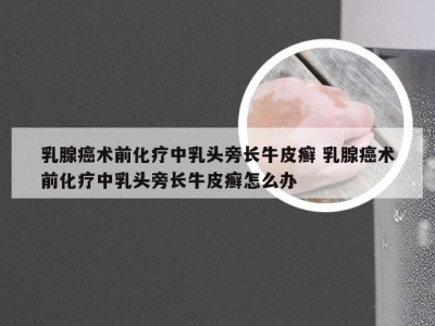 乳腺癌术前化疗中乳头旁长牛皮癣 乳腺癌术前化疗中乳头旁长牛皮癣怎么办