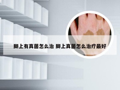 脚上有真菌怎么治 脚上真菌怎么治疗最好