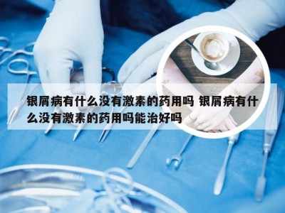 银屑病有什么没有激素的药用吗 银屑病有什么没有激素的药用吗能治好吗