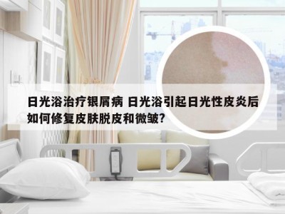 日光浴治疗银屑病 日光浴引起日光性皮炎后如何修复皮肤脱皮和微皱?
