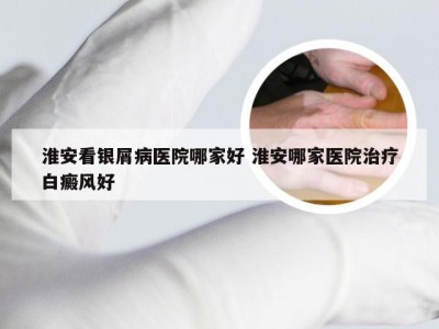 淮安看银屑病医院哪家好 淮安哪家医院治疗白癜风好