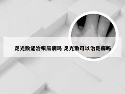 足光散能治银屑病吗 足光散可以治足癣吗