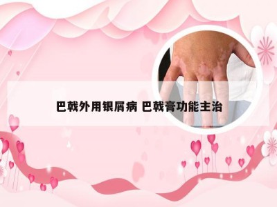 巴戟外用银屑病 巴戟膏功能主治
