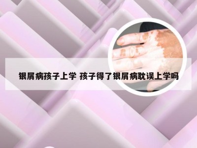 银屑病孩子上学 孩子得了银屑病耽误上学吗
