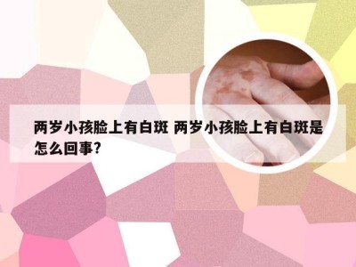 两岁小孩脸上有白斑 两岁小孩脸上有白斑是怎么回事?