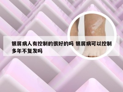银屑病人有控制的很好的吗 银屑病可以控制多年不复发吗