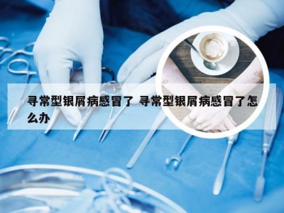 寻常型银屑病感冒了 寻常型银屑病感冒了怎么办