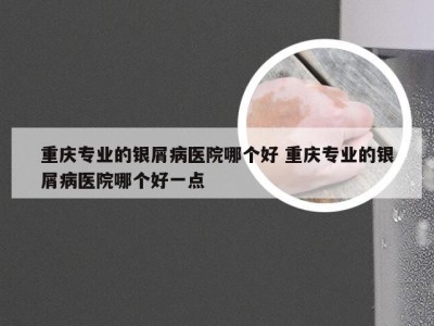 重庆专业的银屑病医院哪个好 重庆专业的银屑病医院哪个好一点