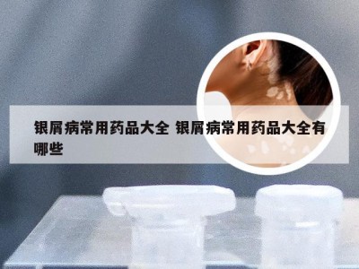 银屑病常用药品大全 银屑病常用药品大全有哪些