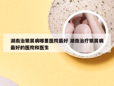 湖南治银屑病哪里医院最好 湖南治疗银屑病最好的医院和医生