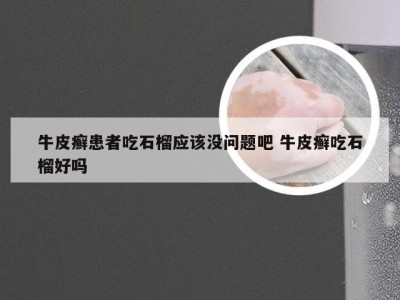 牛皮癣患者吃石榴应该没问题吧 牛皮癣吃石榴好吗