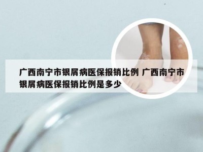 广西南宁市银屑病医保报销比例 广西南宁市银屑病医保报销比例是多少