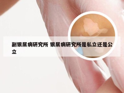 副银屑病研究所 银屑病研究所是私立还是公立