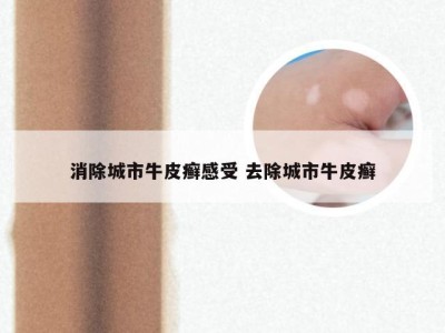 消除城市牛皮癣感受 去除城市牛皮癣