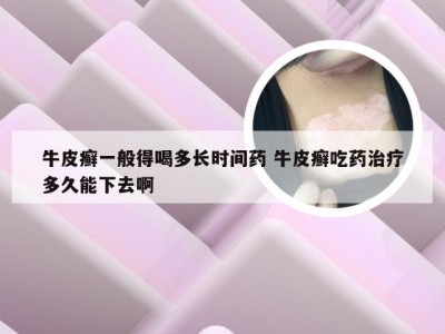 牛皮癣一般得喝多长时间药 牛皮癣吃药治疗多久能下去啊