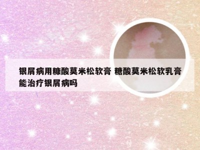 银屑病用糠酸莫米松软膏 糖酸莫米松软乳膏能治疗银屑病吗