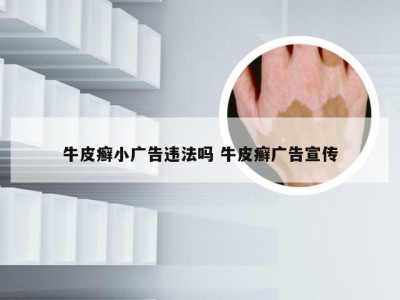 牛皮癣小广告违法吗 牛皮癣广告宣传