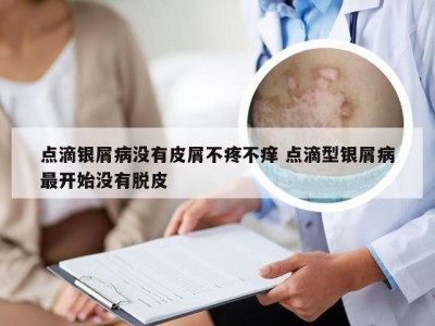 点滴银屑病没有皮屑不疼不痒 点滴型银屑病最开始没有脱皮
