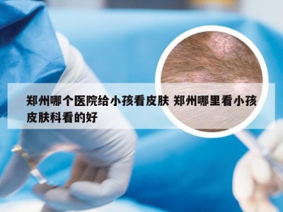 郑州哪个医院给小孩看皮肤 郑州哪里看小孩皮肤科看的好
