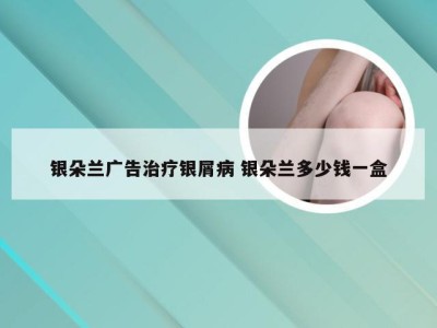 银朵兰广告治疗银屑病 银朵兰多少钱一盒