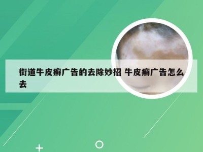 街道牛皮癣广告的去除妙招 牛皮癣广告怎么去