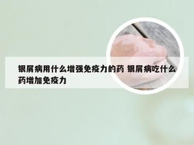 银屑病用什么增强免疫力的药 银屑病吃什么药增加免疫力