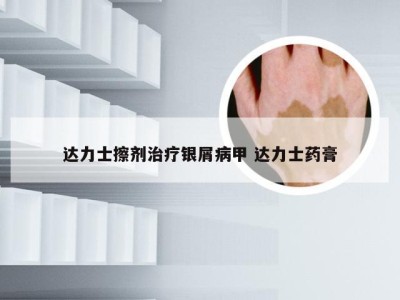 达力士擦剂治疗银屑病甲 达力士药膏