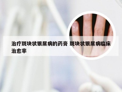 治疗斑块状银屑病的药膏 斑块状银屑病临床治愈率