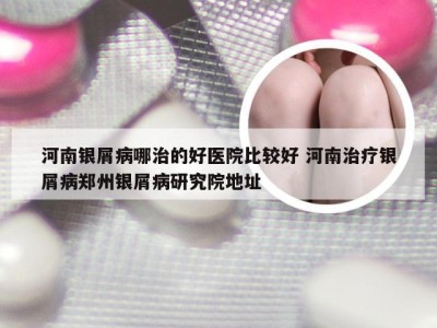 河南银屑病哪治的好医院比较好 河南治疗银屑病郑州银屑病研究院地址