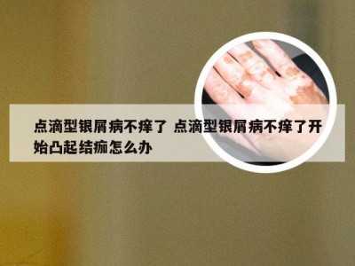 点滴型银屑病不痒了 点滴型银屑病不痒了开始凸起结痂怎么办