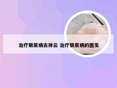 治疗银屑病去祥云 治疗银屑病的医生