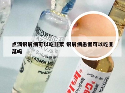 点滴银屑病可以吃韭菜 银屑病患者可以吃韭菜吗