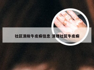 社区清除牛皮癣信息 清理社区牛皮癣