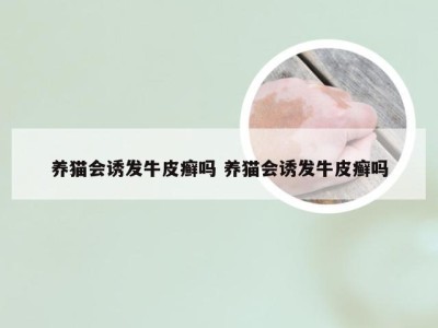 养猫会诱发牛皮癣吗 养猫会诱发牛皮癣吗