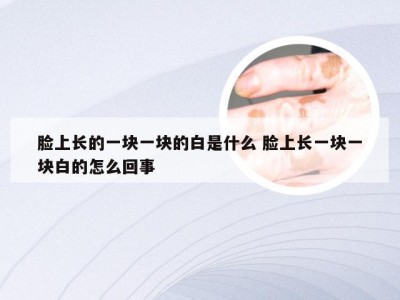 脸上长的一块一块的白是什么 脸上长一块一块白的怎么回事