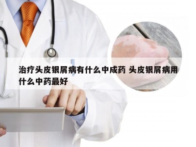 治疗头皮银屑病有什么中成药 头皮银屑病用什么中药最好