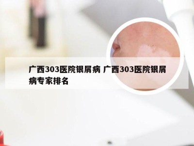 广西303医院银屑病 广西303医院银屑病专家排名